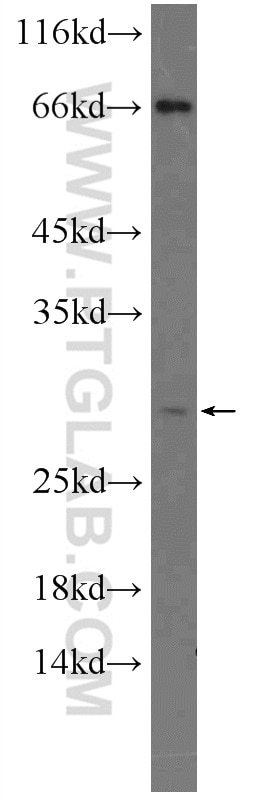 Western Blot (WB) analysis of HEK-293 cells using NDFIP1 Polyclonal antibody (15602-1-AP)