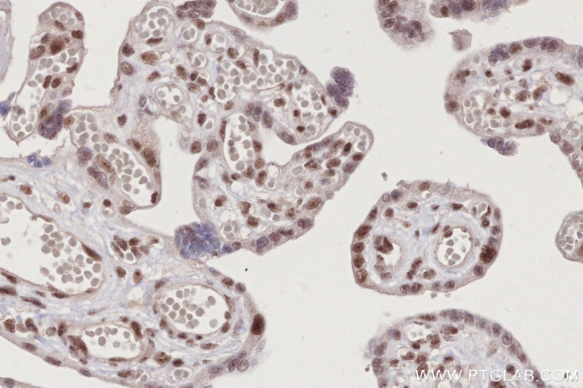 Immunohistochemistry (IHC) staining of human placenta tissue using NDNL2 Polyclonal antibody (27488-1-AP)