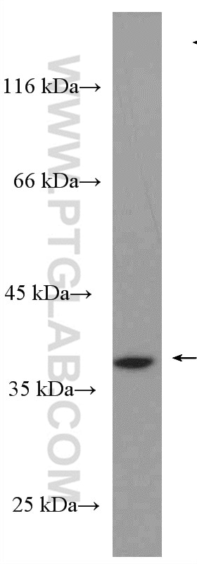 Western Blot (WB) analysis of HeLa cells using NDNL2 Polyclonal antibody (27488-1-AP)