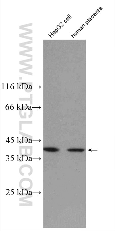 Western Blot (WB) analysis of human placenta tissue using NDNL2 Polyclonal antibody (27488-1-AP)