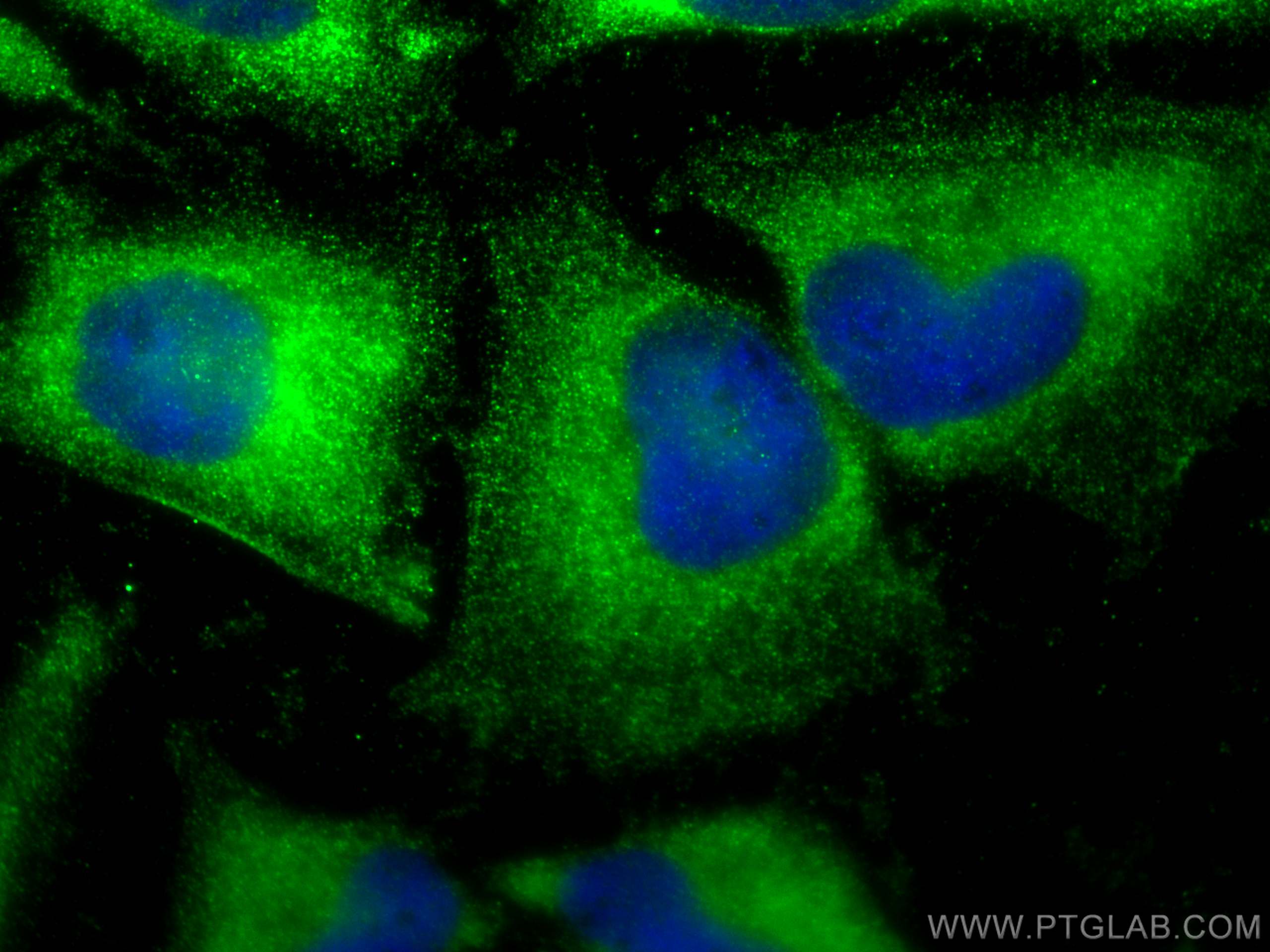 Immunofluorescence (IF) / fluorescent staining of HeLa cells using NDOR1/NR1 Polyclonal antibody (11404-1-AP)