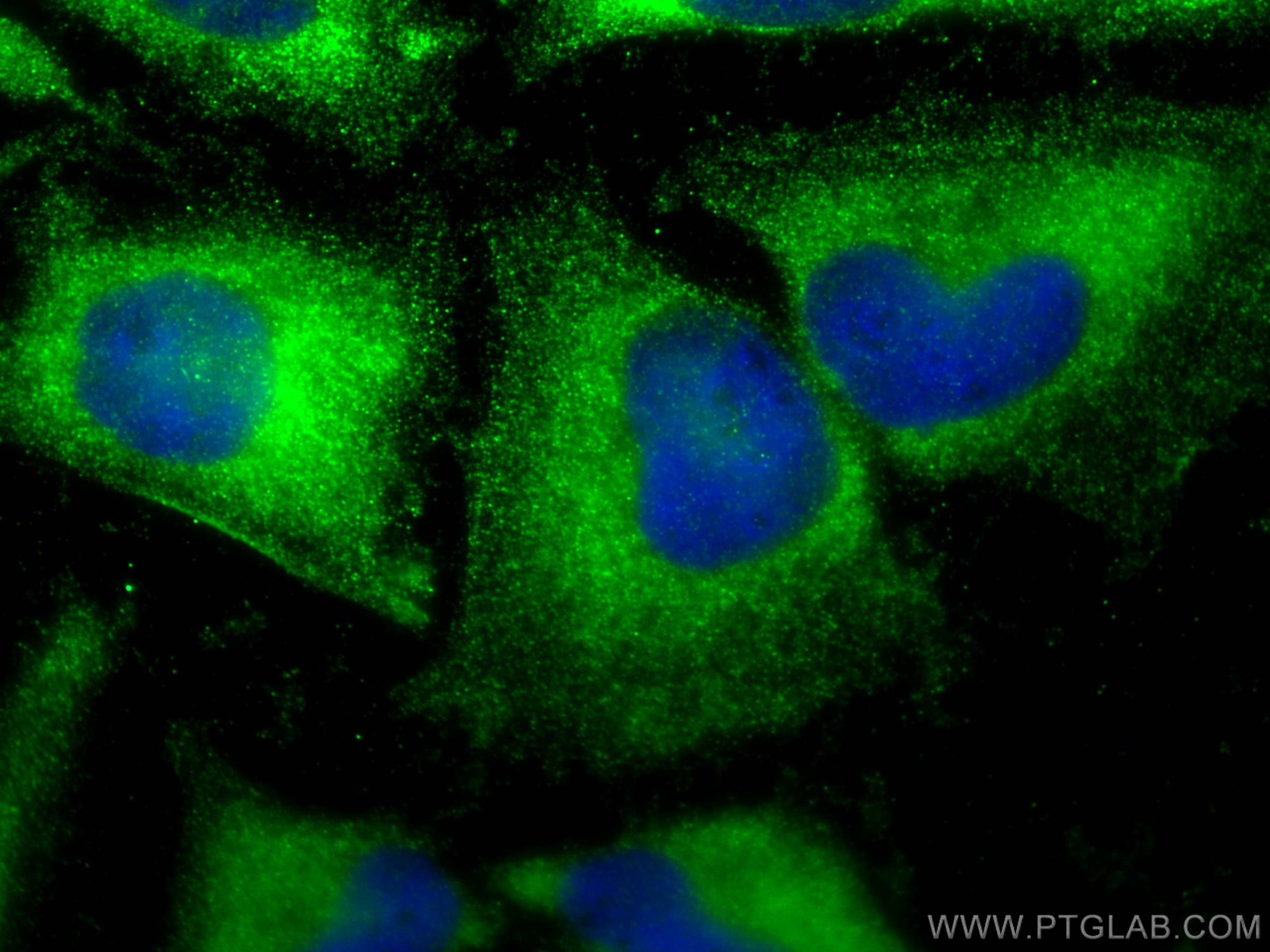 IF Staining of HeLa using 11404-1-AP