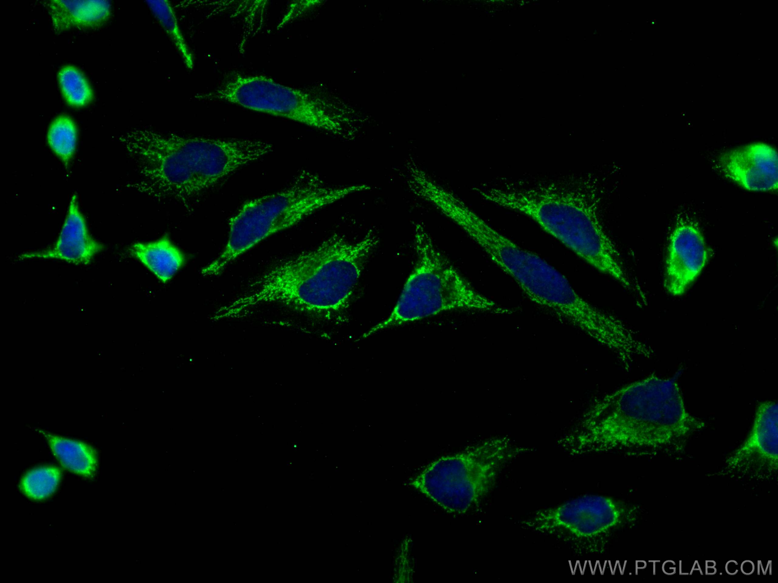 Immunofluorescence (IF) / fluorescent staining of HeLa cells using NDOR1/NR1 Polyclonal antibody (11404-1-AP)