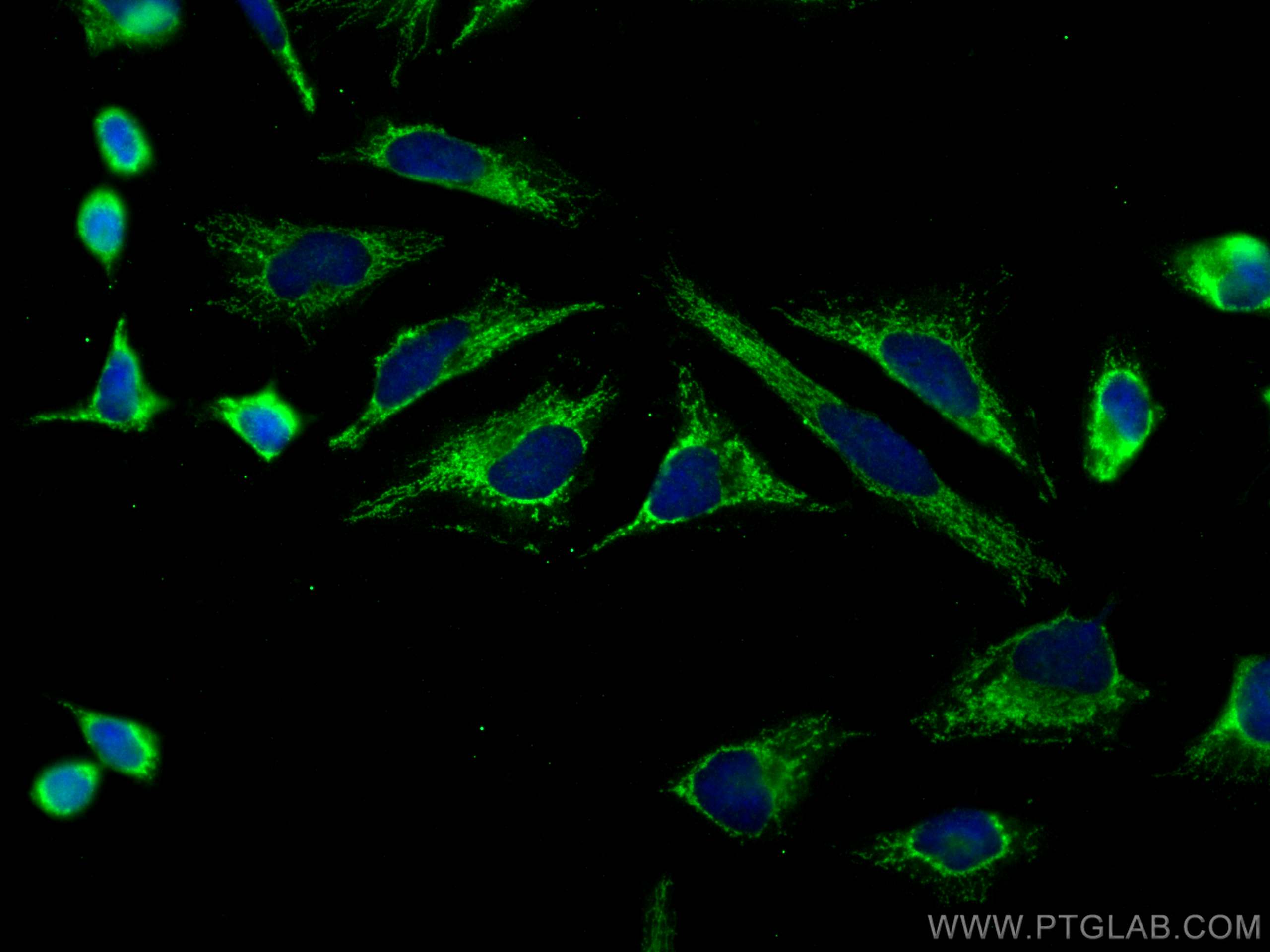 IF Staining of HeLa using 11404-1-AP