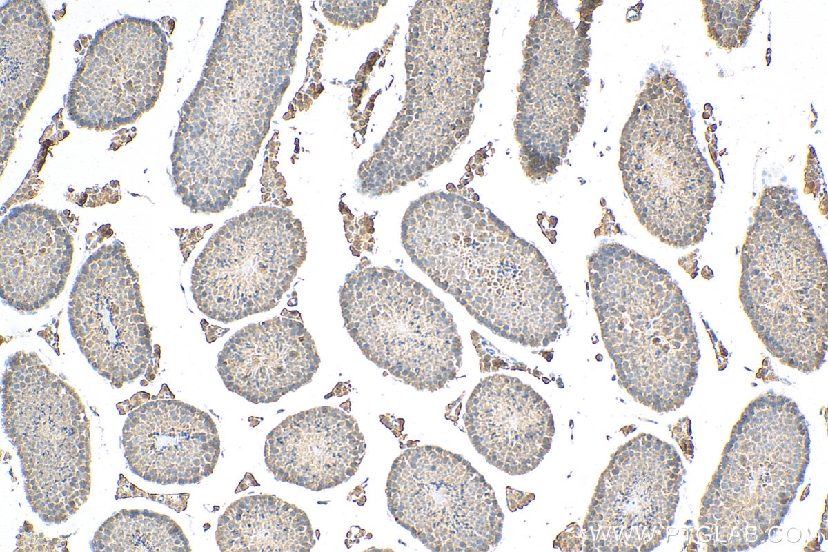 Immunohistochemistry (IHC) staining of mouse testis tissue using NDOR1/NR1 Polyclonal antibody (11404-1-AP)
