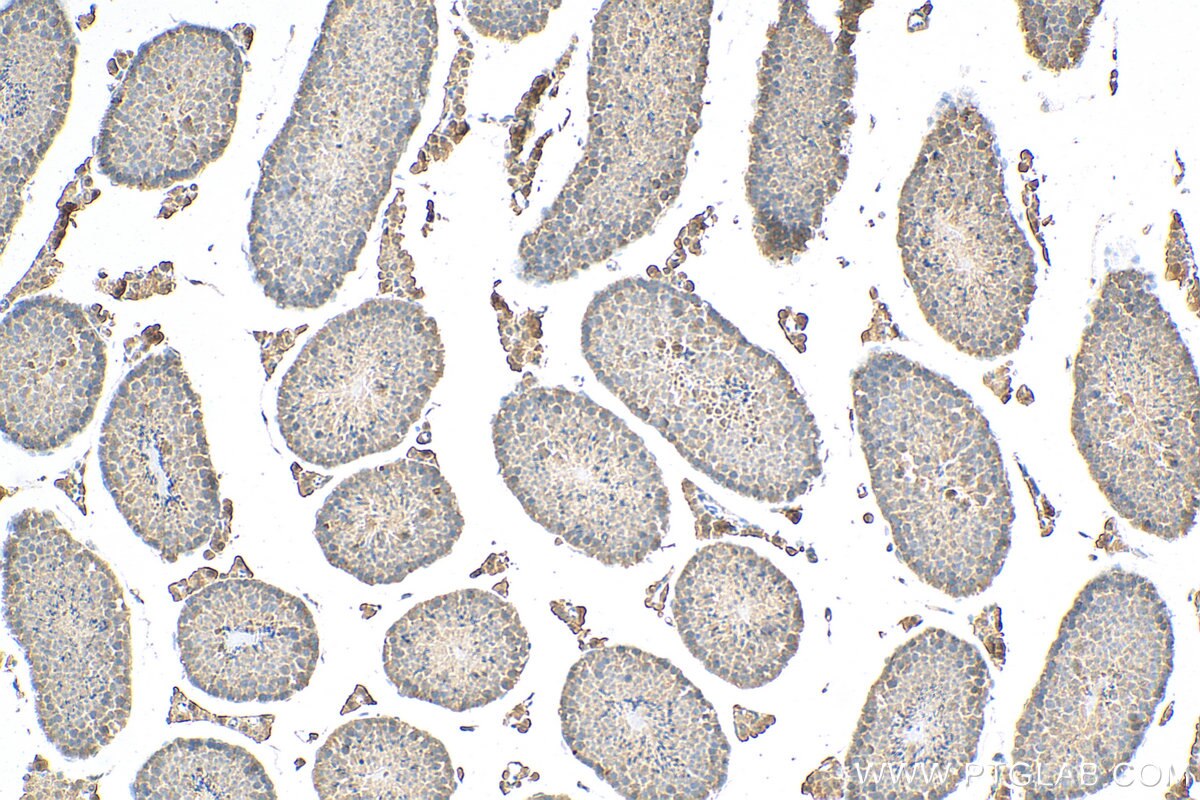 IHC staining of mouse testis using 11404-1-AP