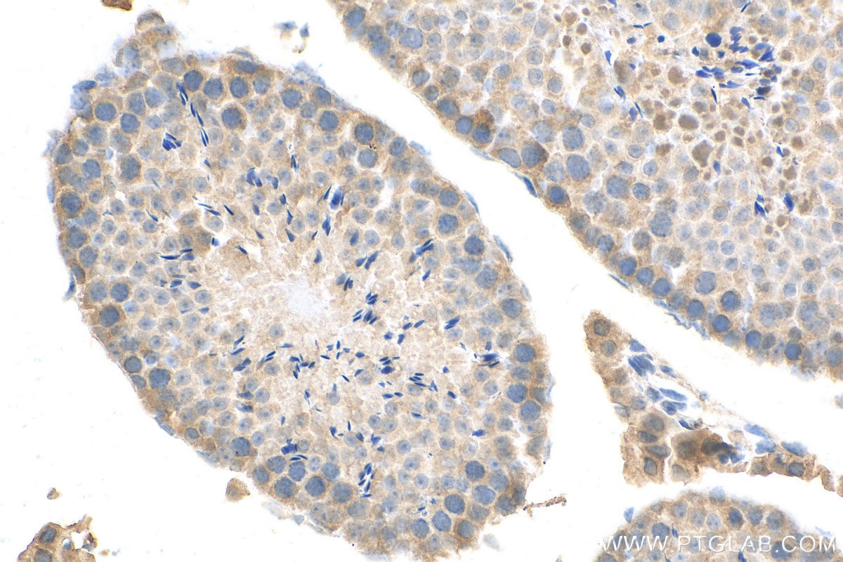 Immunohistochemistry (IHC) staining of mouse testis tissue using NDOR1/NR1 Polyclonal antibody (11404-1-AP)