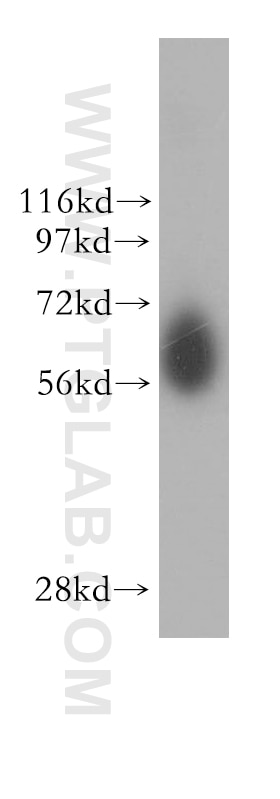 Western Blot (WB) analysis of human liver tissue using NDOR1/NR1 Polyclonal antibody (11404-1-AP)