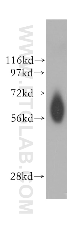 Western Blot (WB) analysis of human spleen tissue using NDOR1/NR1 Polyclonal antibody (11404-1-AP)