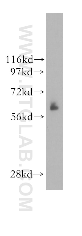 Western Blot (WB) analysis of human lung tissue using NDOR1/NR1 Polyclonal antibody (11404-1-AP)