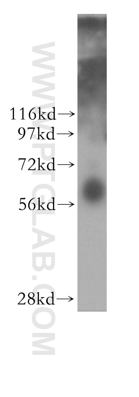 WB analysis of mouse thymus using 11404-1-AP