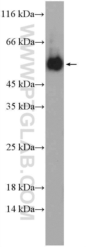 WB analysis of mouse testis using 15380-1-AP