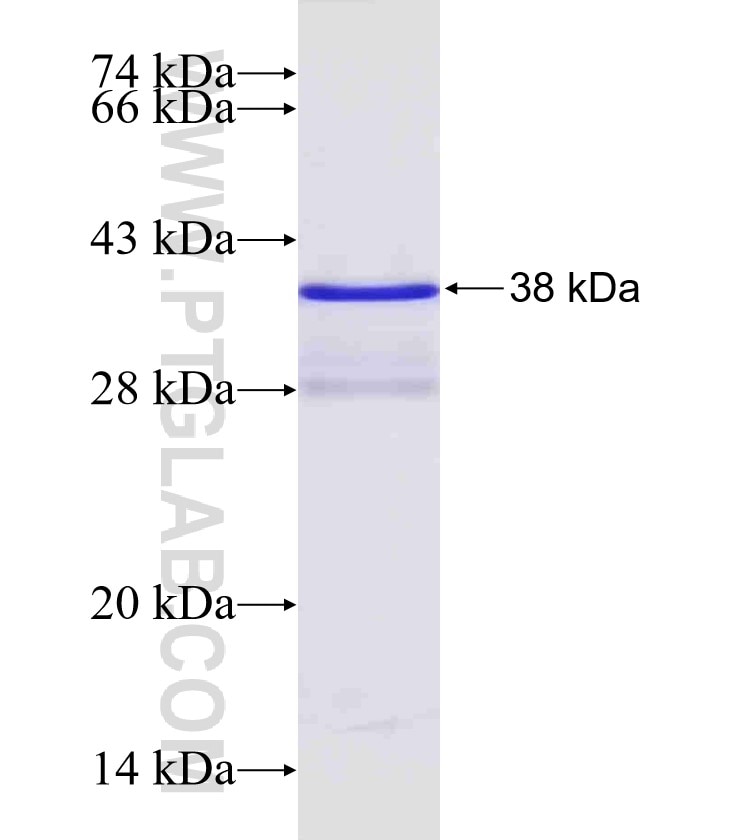NDP fusion protein Ag4066 SDS-PAGE