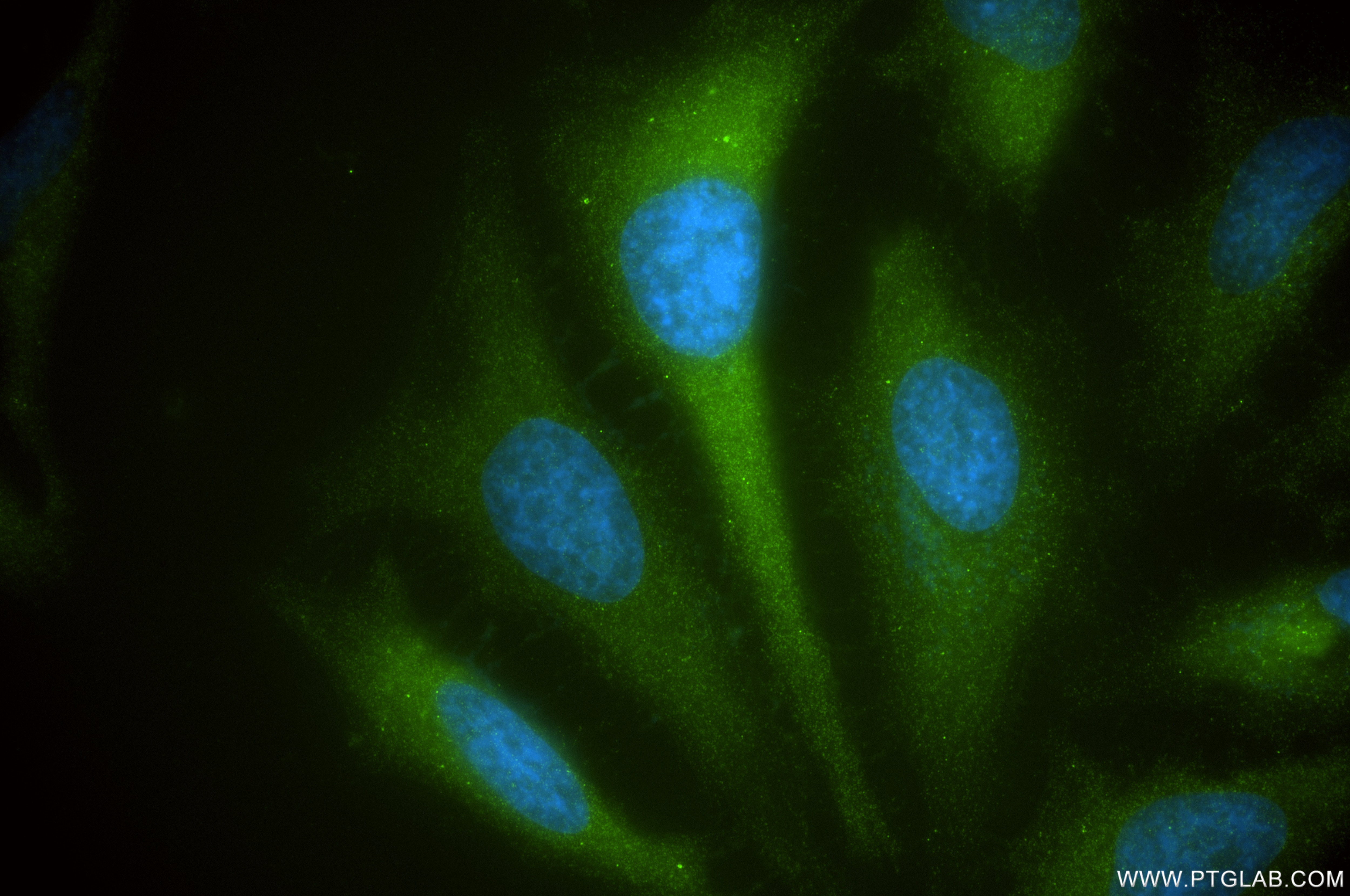 Immunofluorescent analysis of (-20°C Ethanol) fixed HeLa cells using NDP52 antibody (86167-1-RR, Clone: 250714E9 ) at dilution of 1:400 and CoraLite®488-Conjugated Goat Anti-Rabbit IgG(H+L) (SA00013-2). Immunofluorescence (IF) / fluorescent staining of HeLa cells using NDP52 Recombinant antibody (86167-1-RR)