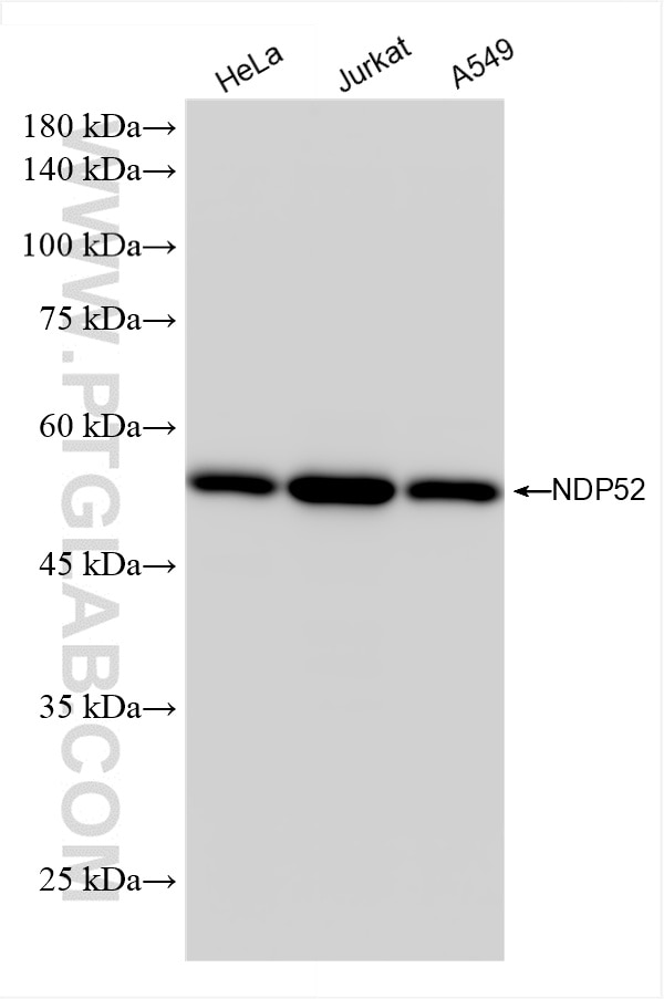 Various lysates were subjected to SDS PAGE followed by western blot with 86167-1-RR (NDP52 antibody) at dilution of 1:10000 incubated at room temperature for 1.5 hours. Western Blot (WB) analysis of various lysates using NDP52 Recombinant antibody (86167-1-RR)