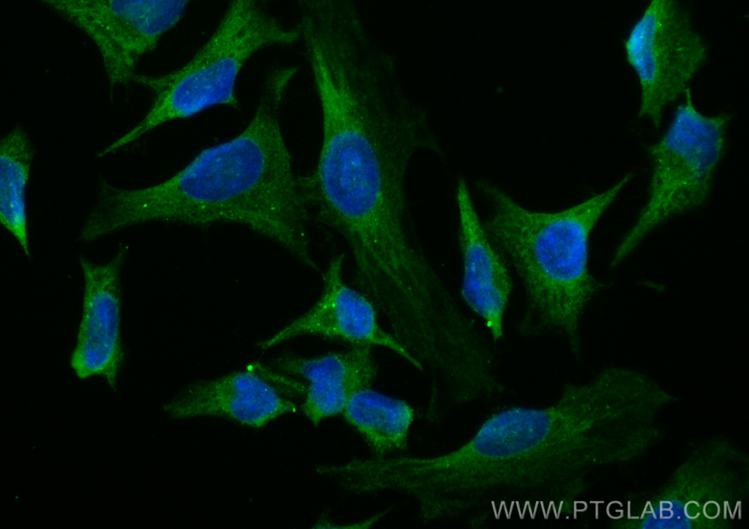 Immunofluorescence (IF) / fluorescent staining of HeLa cells using CoraLite® Plus 488-conjugated NDP52 Polyclonal ant (CL488-12229)