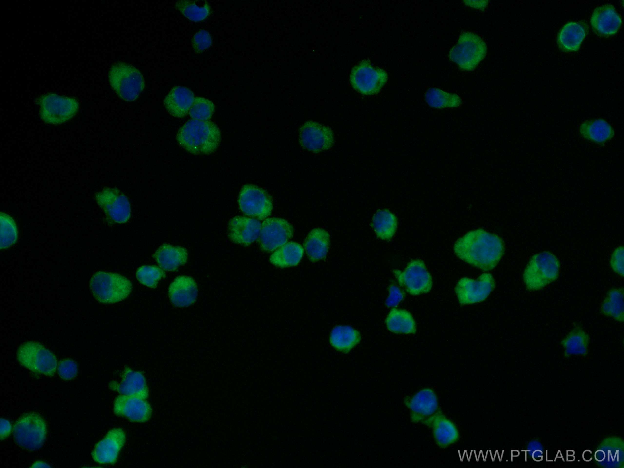 Immunofluorescence (IF) / fluorescent staining of Jurkat cells using CoraLite® Plus 488-conjugated NDP52 Monoclonal ant (CL488-66401)