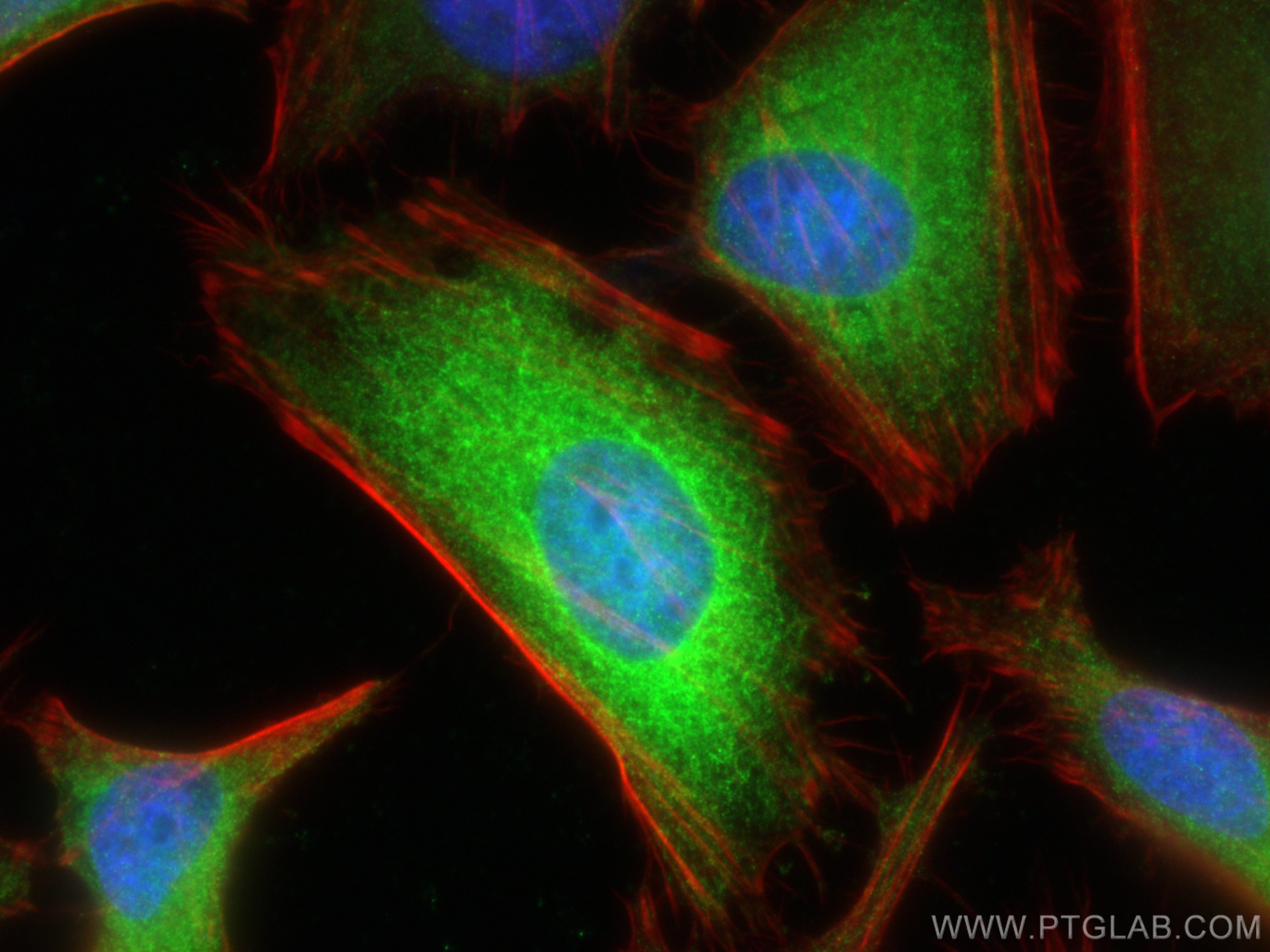 Immunofluorescence (IF) / fluorescent staining of HeLa cells using NDRG1 Polyclonal antibody (26902-1-AP)