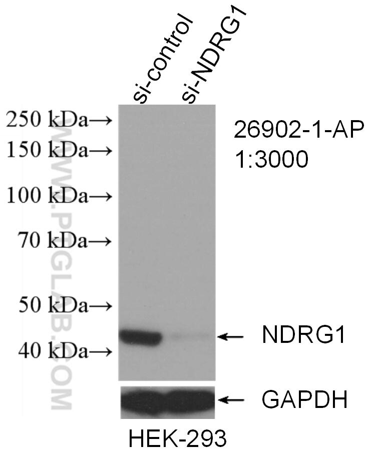 Western Blot (WB) analysis of HEK-293 cells using NDRG1 Polyclonal antibody (26902-1-AP)