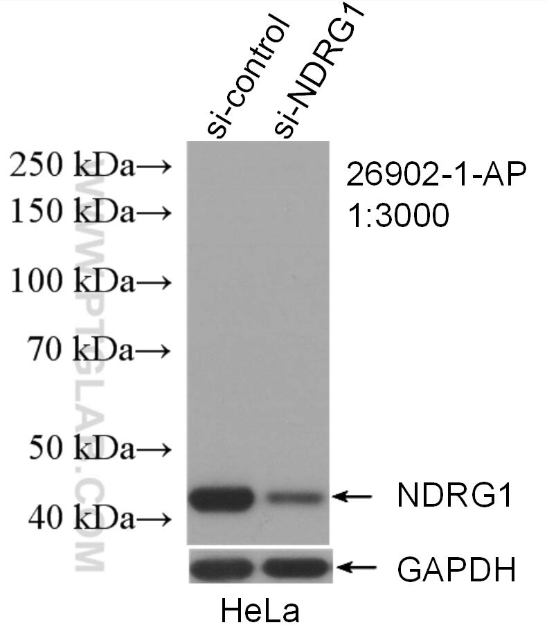 Western Blot (WB) analysis of HeLa cells using NDRG1 Polyclonal antibody (26902-1-AP)