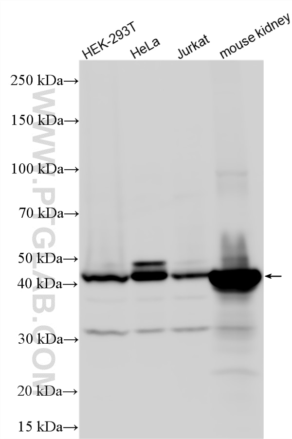 Western Blot (WB) analysis of various lysates using NDRG1 Polyclonal antibody (26902-1-AP)
