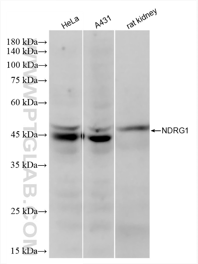 Western Blot (WB) analysis of various lysates using NDRG1 Recombinant antibody (85141-4-RR)