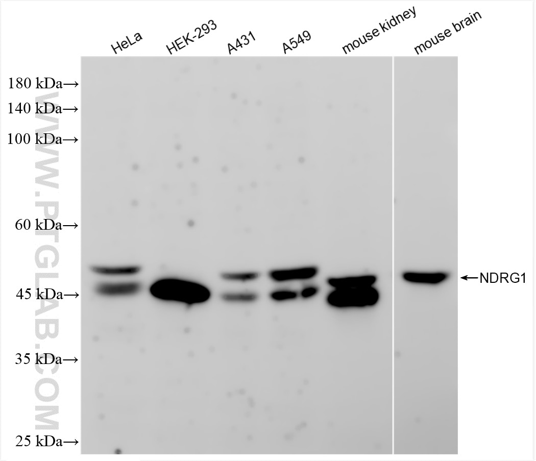 Western Blot (WB) analysis of various lysates using NDRG1 Recombinant antibody (85141-4-RR)