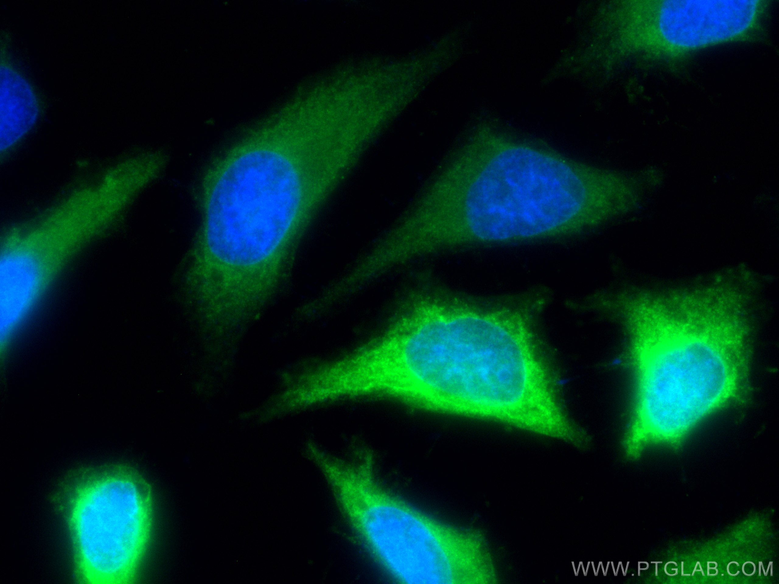 Immunofluorescence (IF) / fluorescent staining of HeLa cells using CoraLite® Plus 488-conjugated NDRG1 Polyclonal ant (CL488-26902)