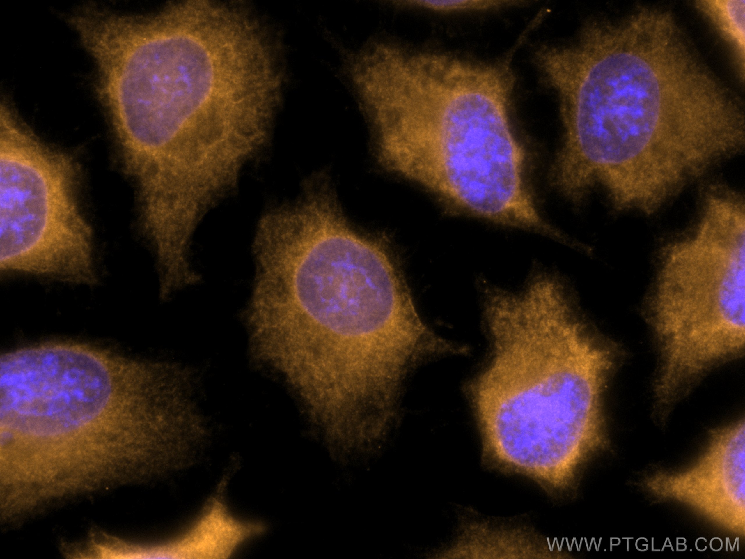 Immunofluorescence (IF) / fluorescent staining of HeLa cells using CoraLite®555-conjugated NDRG1 Polyclonal antibody (CL555-26902)