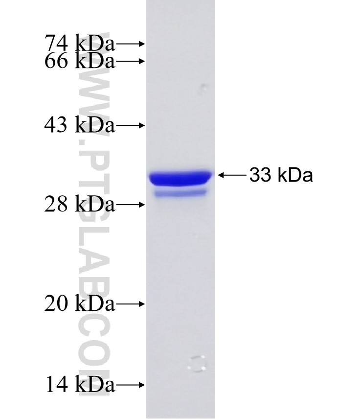 NDRG1 fusion protein Ag25424 SDS-PAGE