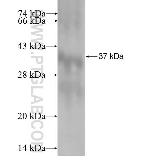 NDRG1 fusion protein Ag0908 SDS-PAGE