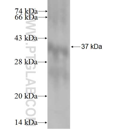 NDRG1 fusion protein Ag0908 SDS-PAGE