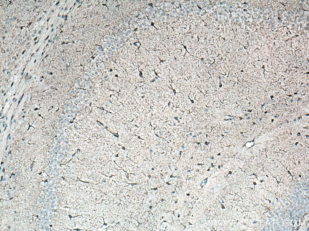 Immunohistochemistry (IHC) staining of mouse brain tissue using NDRG2 Polyclonal antibody (12015-1-AP)