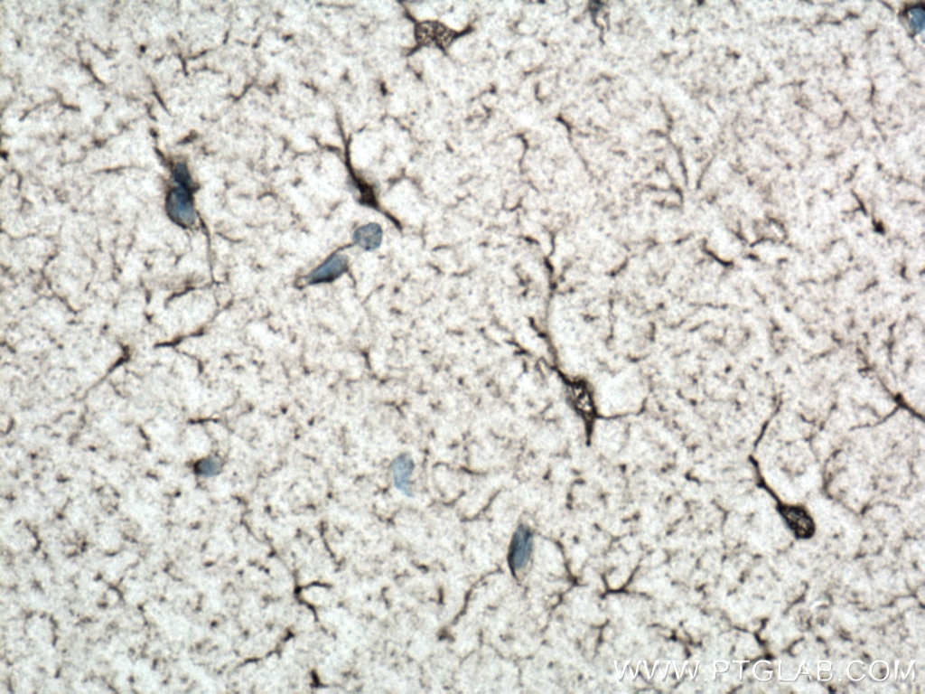 Immunohistochemistry (IHC) staining of mouse brain tissue using NDRG2 Polyclonal antibody (12015-1-AP)
