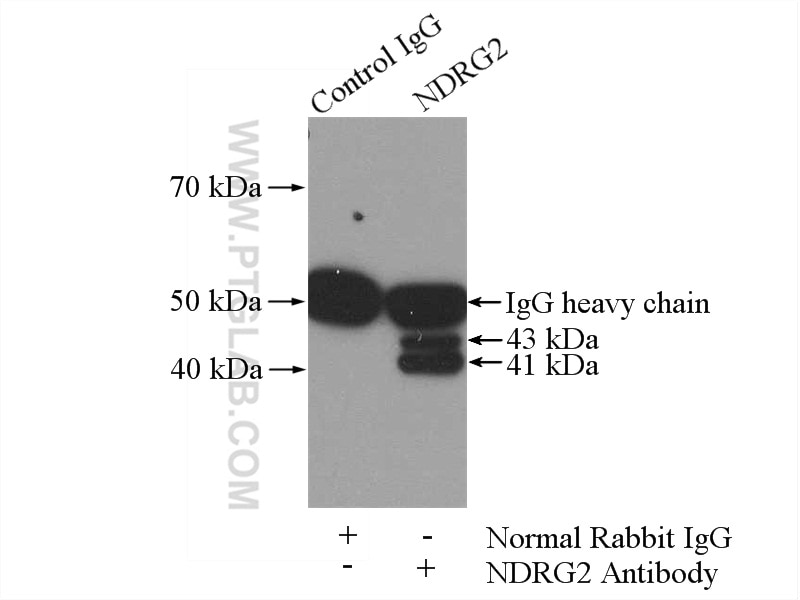 IP experiment of rat brain using 12015-1-AP