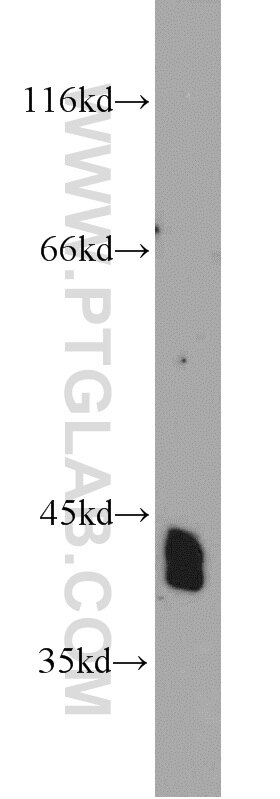 Western Blot (WB) analysis of rat brain tissue using NDRG2 Polyclonal antibody (12015-1-AP)