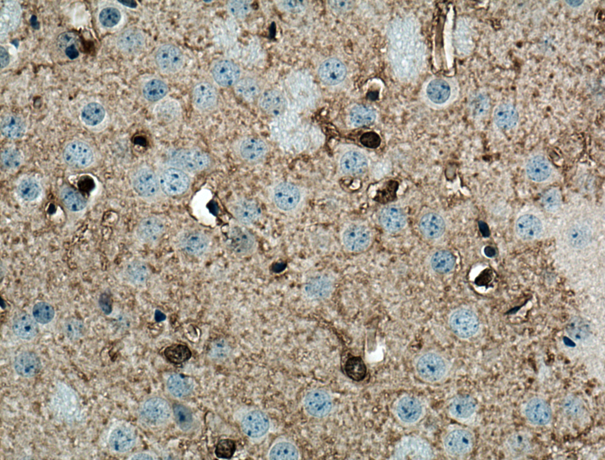 Immunohistochemistry (IHC) staining of mouse brain tissue using NDRG2 Monoclonal antibody (67191-1-Ig)