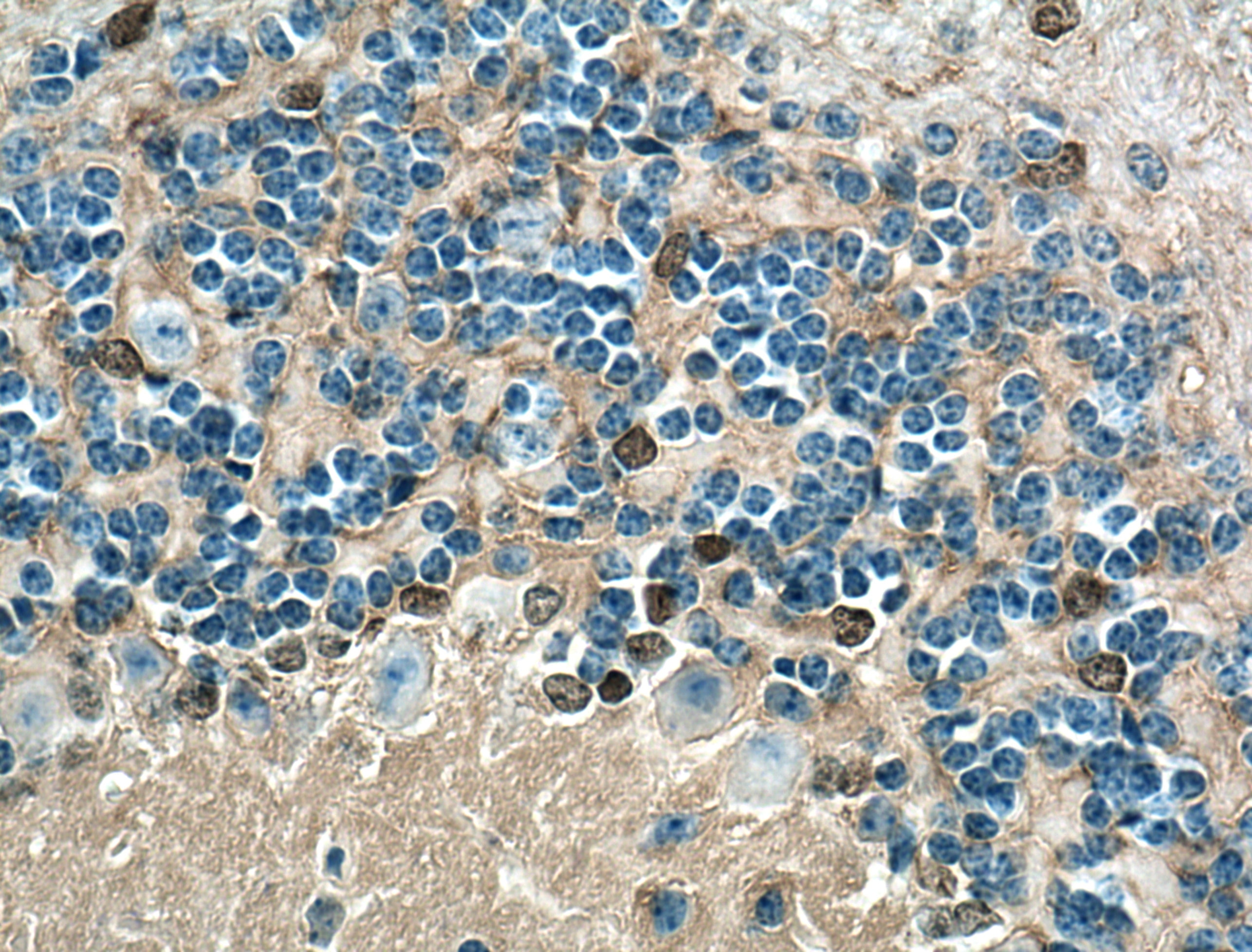 Immunohistochemistry (IHC) staining of mouse cerebellum tissue using NDRG2 Monoclonal antibody (67191-1-Ig)
