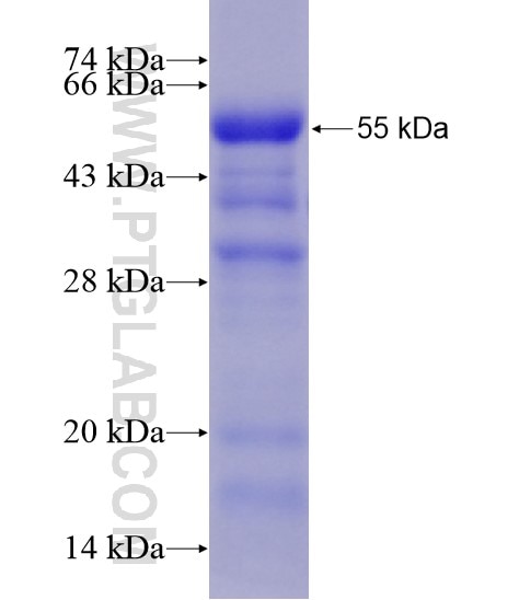 NDRG2 fusion protein Ag28612 SDS-PAGE