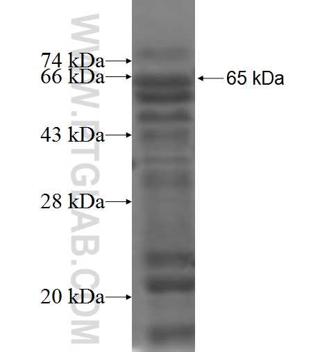 NDRG2 fusion protein Ag2629 SDS-PAGE