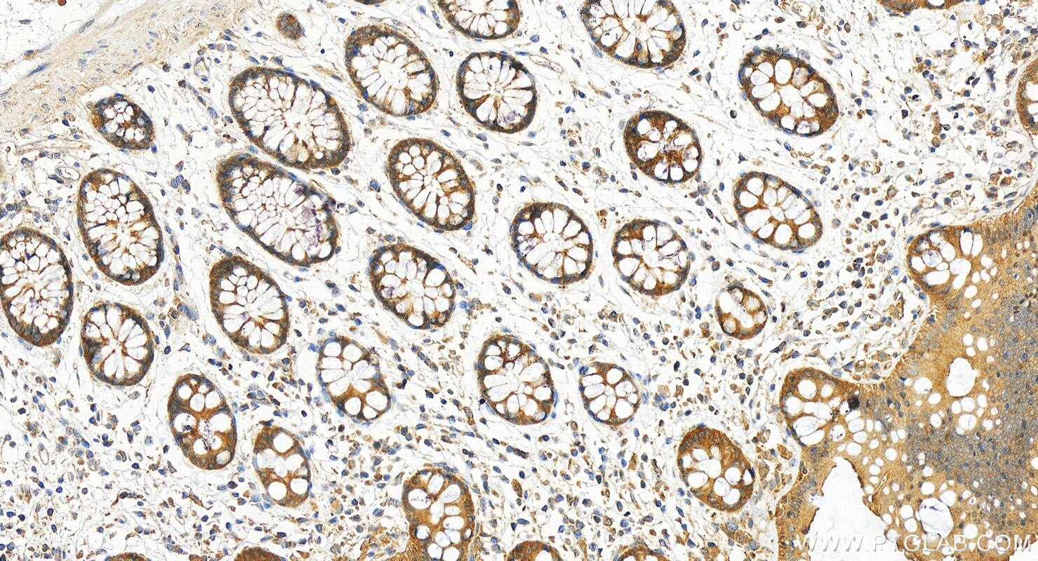 Immunohistochemistry (IHC) staining of human colon tissue using NDRG3 Polyclonal antibody (31421-1-AP)