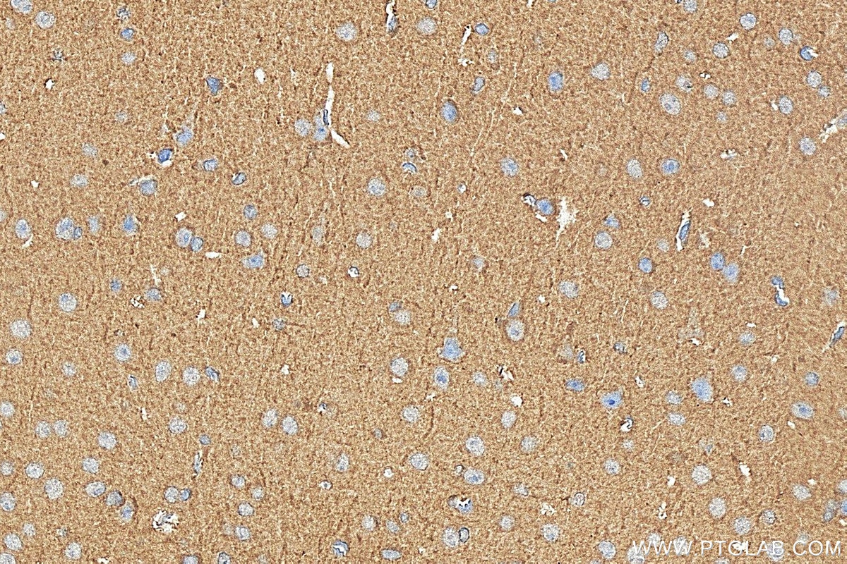 IHC staining of mouse brain using 31421-1-AP (same clone as 31421-1-PBS) Immunohistochemistry (IHC) staining of mouse brain tissue using NDRG3 Polyclonal antibody (31421-1-AP)