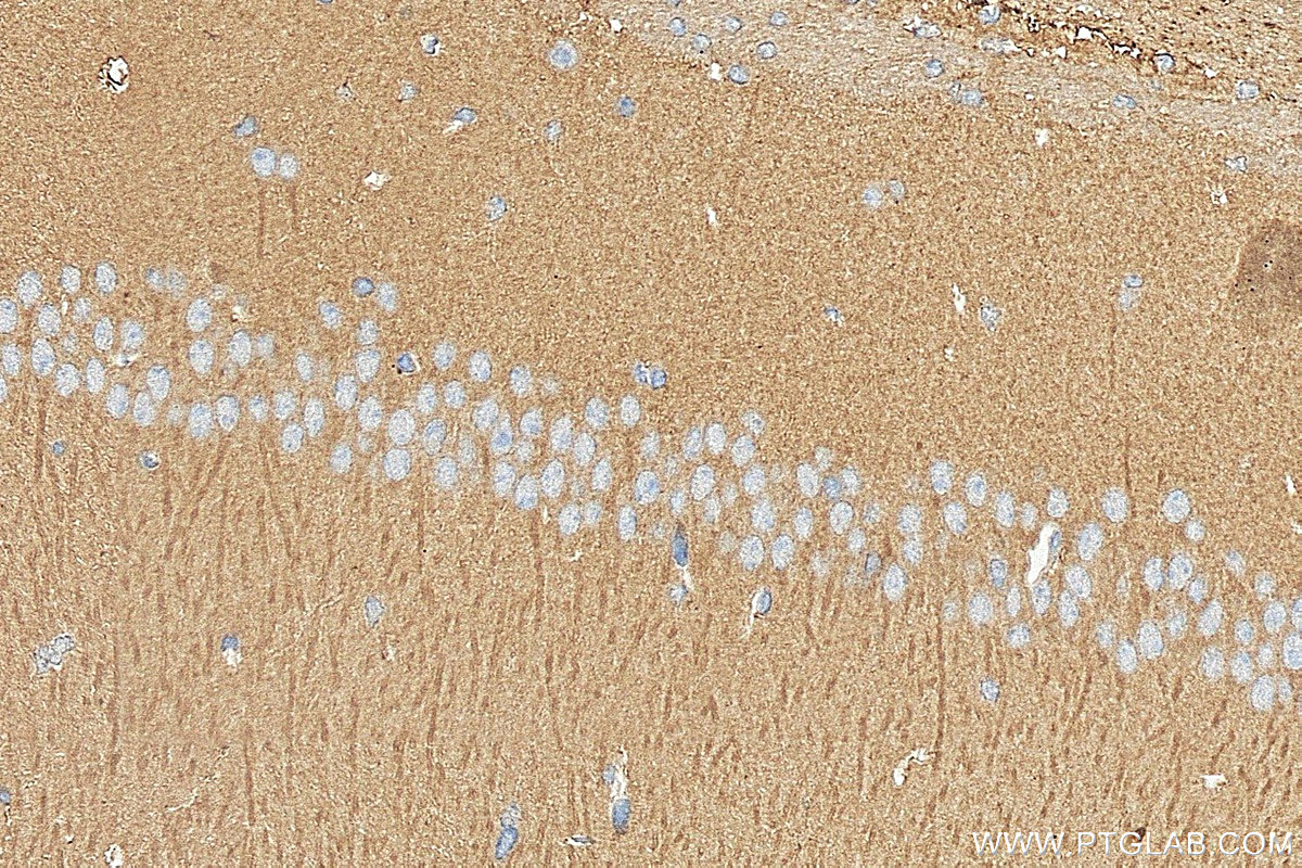 IHC staining of mouse brain using 31421-1-AP (same clone as 31421-1-PBS) Immunohistochemistry (IHC) staining of mouse brain tissue using NDRG3 Polyclonal antibody (31421-1-AP)