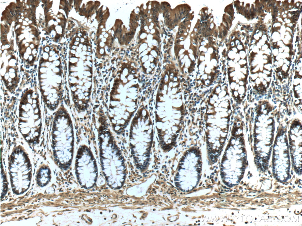 Immunohistochemistry (IHC) staining of human colon tissue using NDRG4 Polyclonal antibody (12184-1-AP)