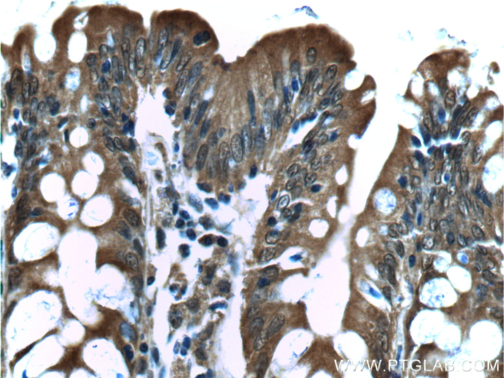 Immunohistochemistry (IHC) staining of human colon tissue using NDRG4 Polyclonal antibody (12184-1-AP)