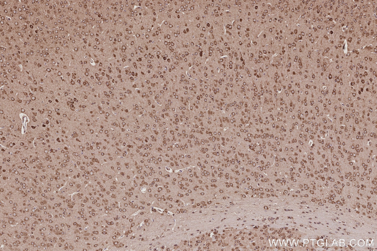 Immunohistochemistry (IHC) staining of mouse brain tissue using NDRG4 Polyclonal antibody (12184-1-AP)