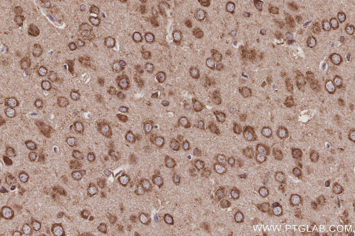 IHC staining of mouse brain using 12184-1-AP Immunohistochemistry (IHC) staining of mouse brain tissue using NDRG4 Polyclonal antibody (12184-1-AP)