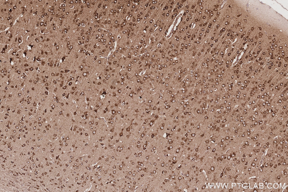 Immunohistochemistry (IHC) staining of rat brain tissue using NDRG4 Polyclonal antibody (12184-1-AP)