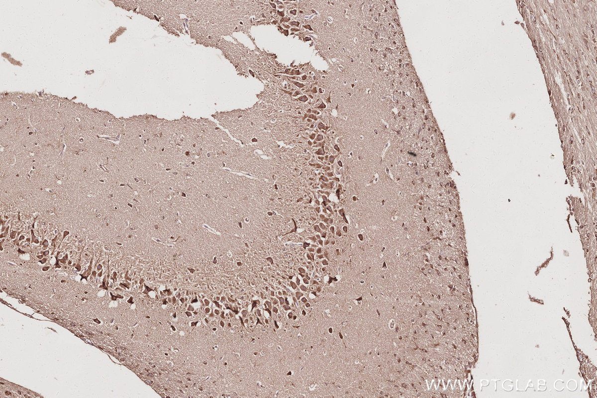 Immunohistochemistry (IHC) staining of rat brain tissue using NDRG4 Polyclonal antibody (12184-1-AP)