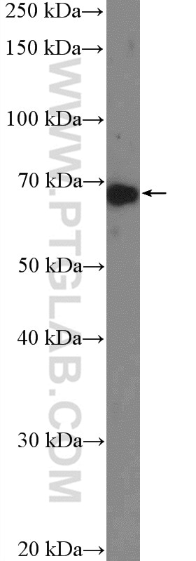 Western Blot (WB) analysis of mouse heart tissue using NDST1 Polyclonal antibody (26203-1-AP)